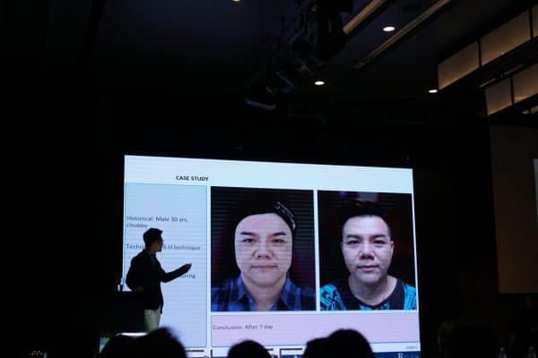 ไหมอิตาลี