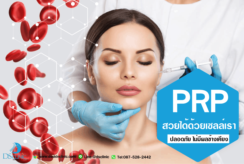 PRP ย้อนผิว ย้อนวัย ด้วยกลไกธรรมชาติ.