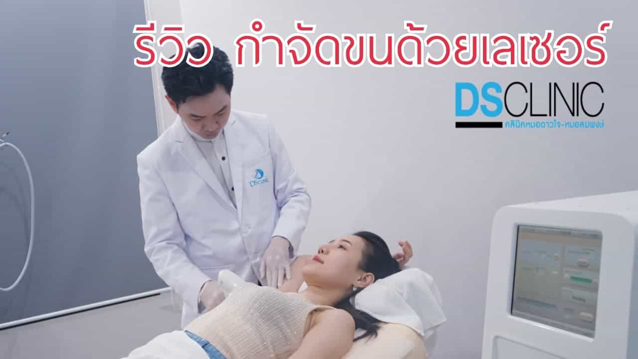 รีวิวเลเซอร์กำจัดขนที่ DS Clinic โดยแพทย์ผู้เชี่ยวชาญ ใช้เทคโนโลยี Diode Laser ให้ผลลัพธ์ปลอดภัยและไ.