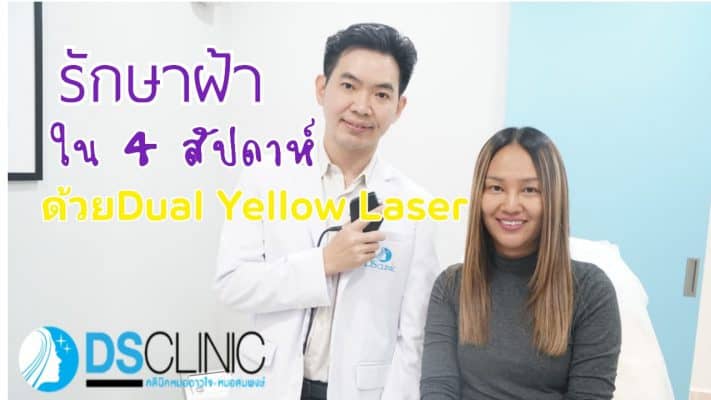 dualyellow laser