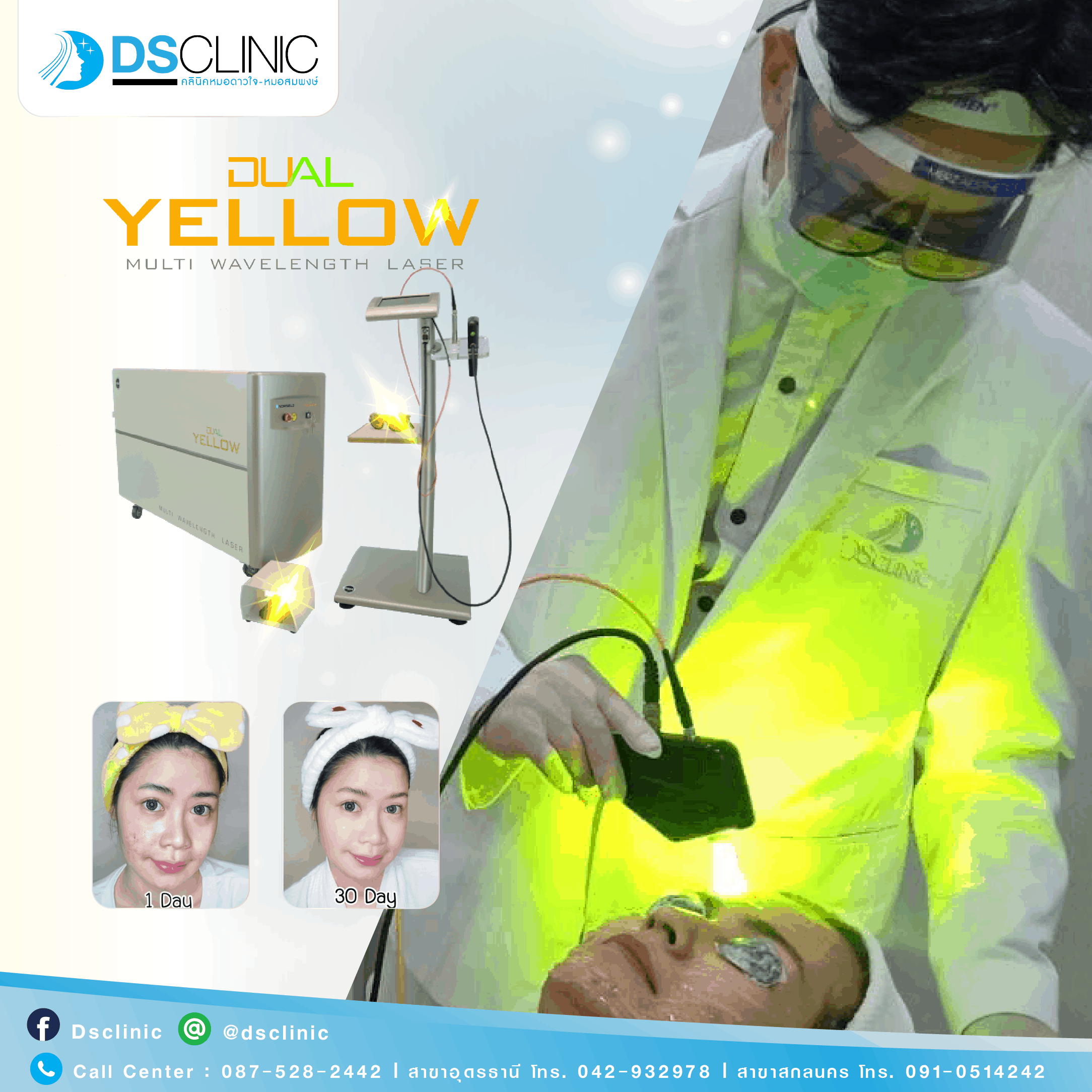 dual-yellow-laser-ladyissue