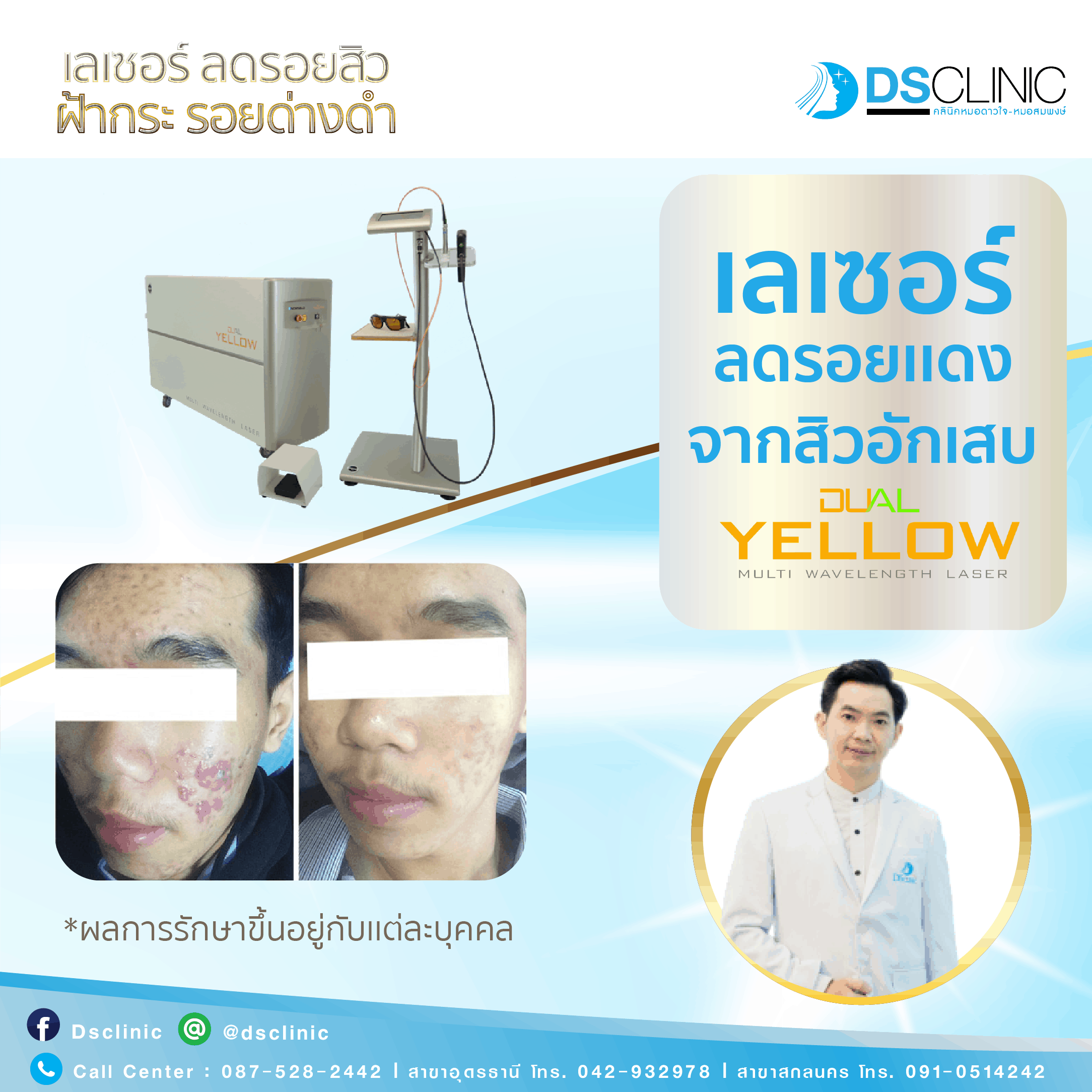 review dual yellow