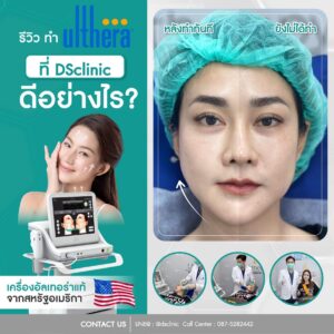 อัลเทอรา