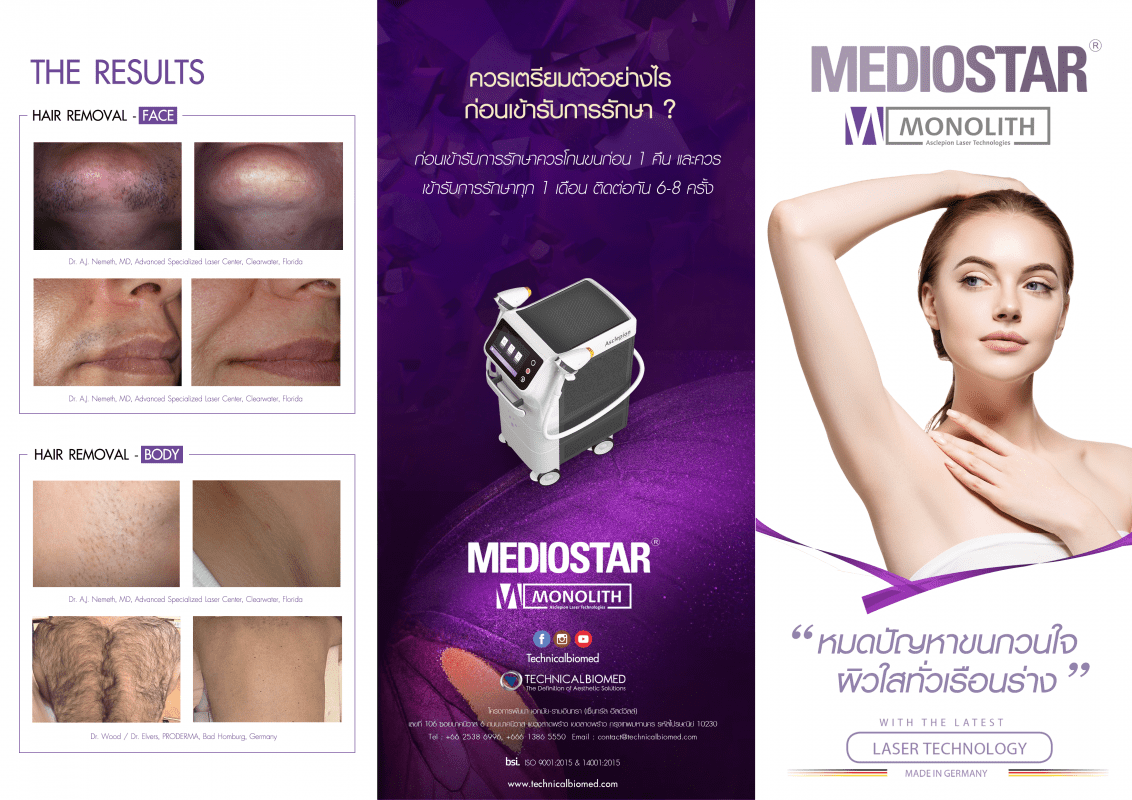 กำจัดขน ds คลินิก