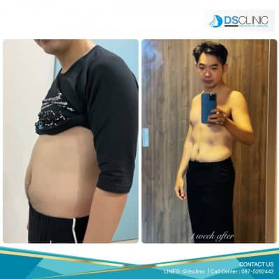 รีวิว wonder sixpack