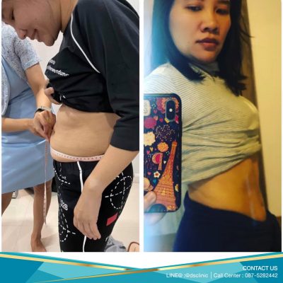 รีวิว wondersixpack