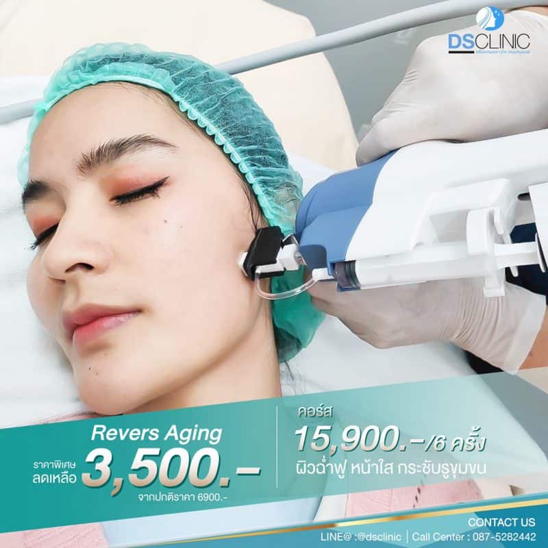 โปรโมชั่น