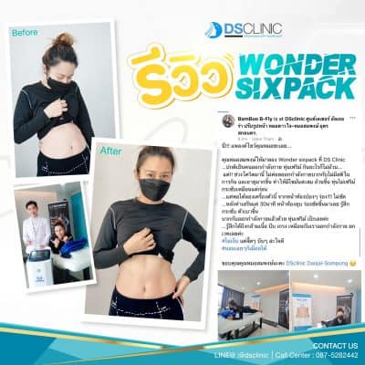 รีวิว wonder sixpack