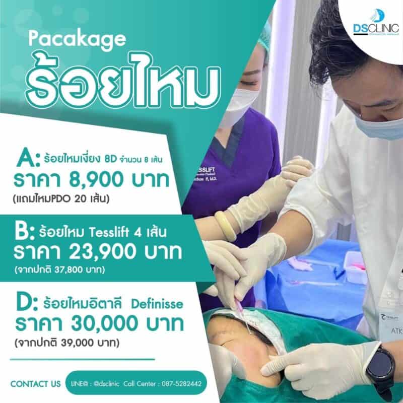 โปรรโมชั่น รอยไหม