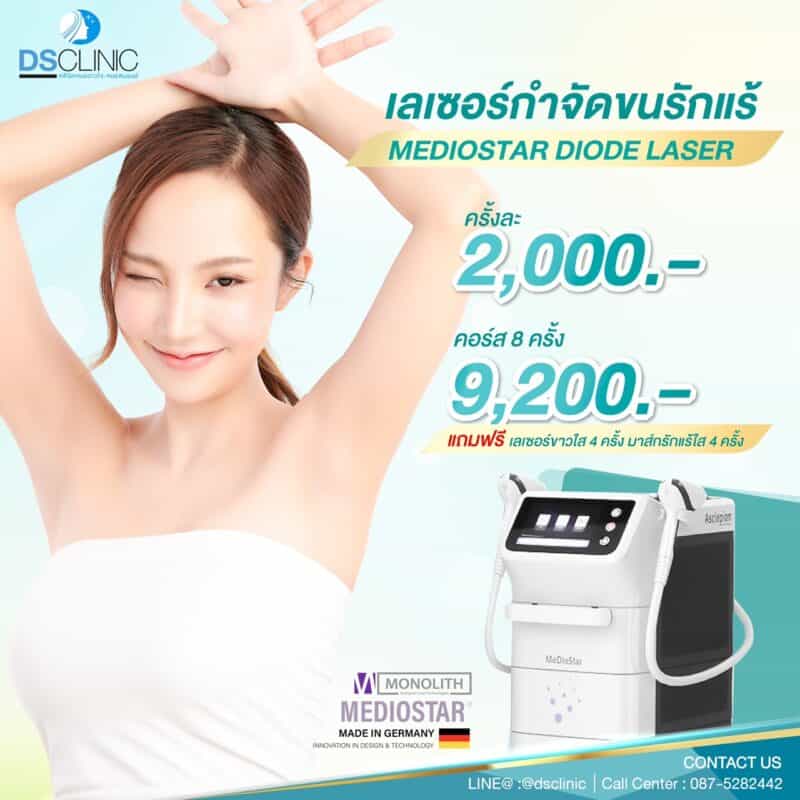 โปรโมชั้น กำจัดขน