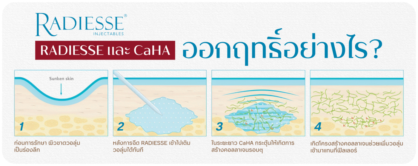 Radiesseออกฤทธิ์อย่างไร