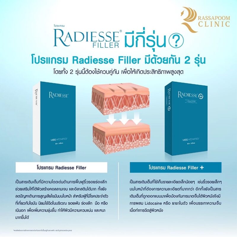 Radiesse Fillerมีกี่รุ่น