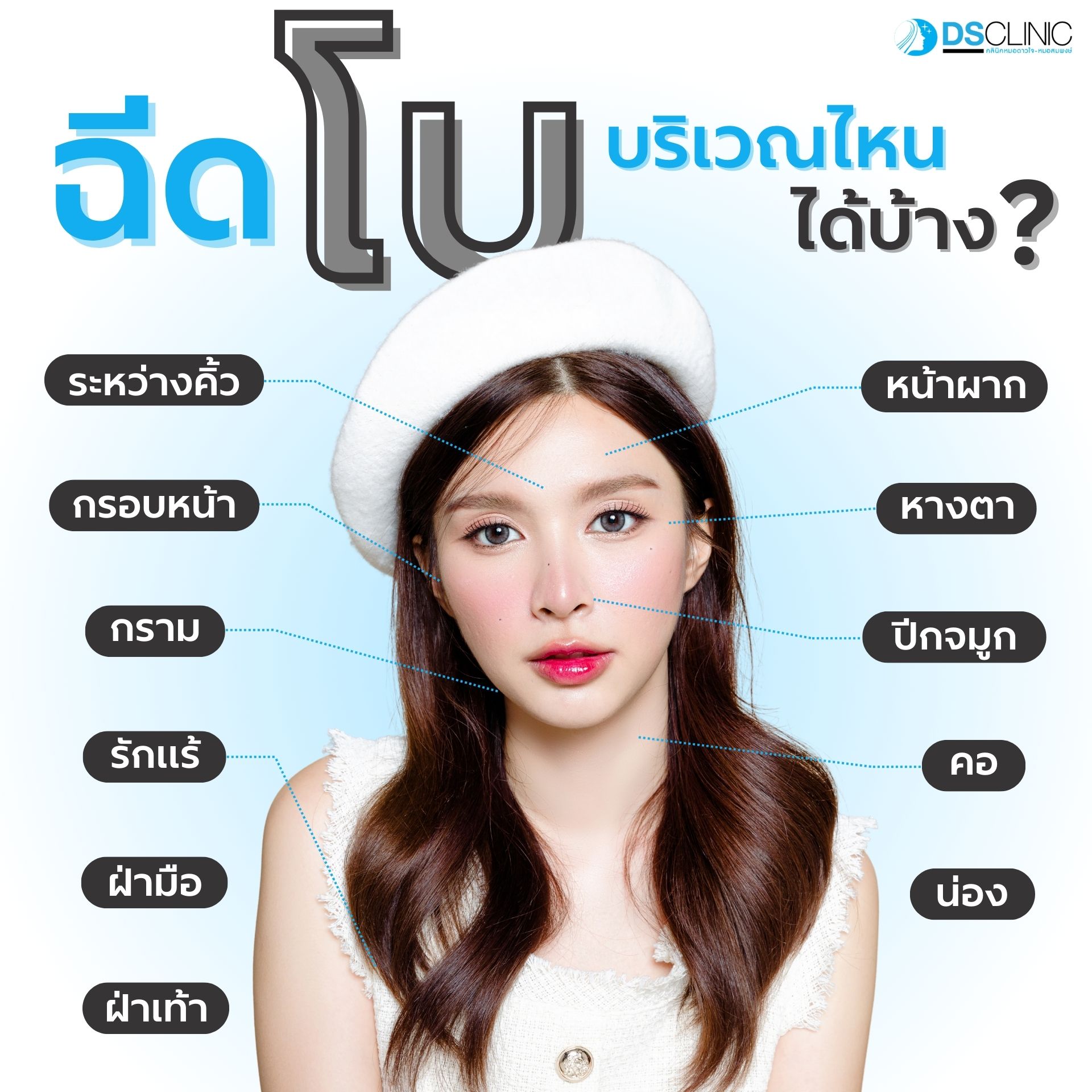 รูปภาพประกอบฉีด Botox บริเวณไหนได้บ้าง