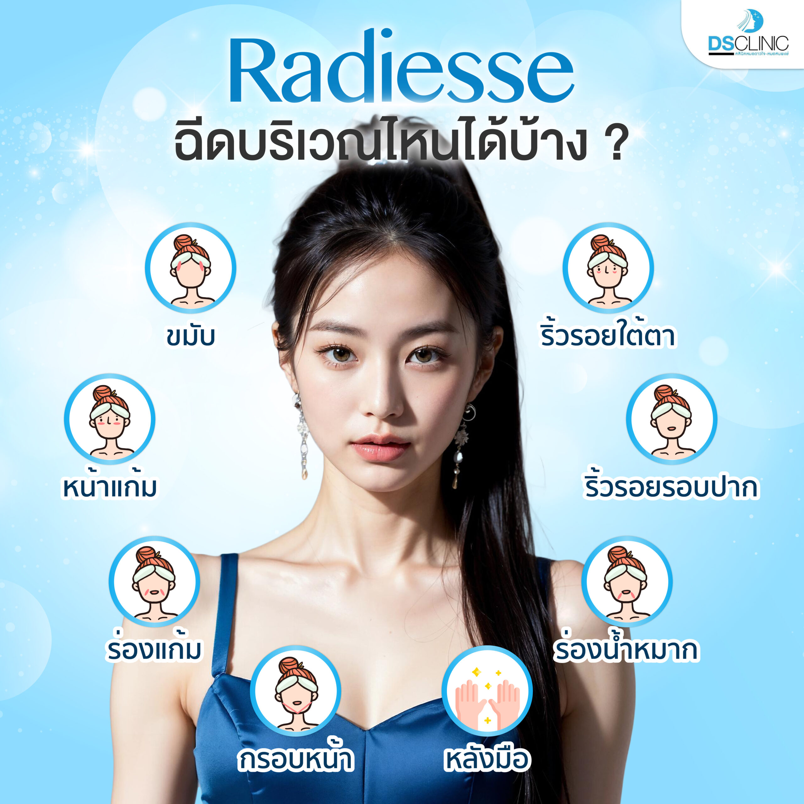 Radiesse ฉีดบริเวณไหนได้บ้าง