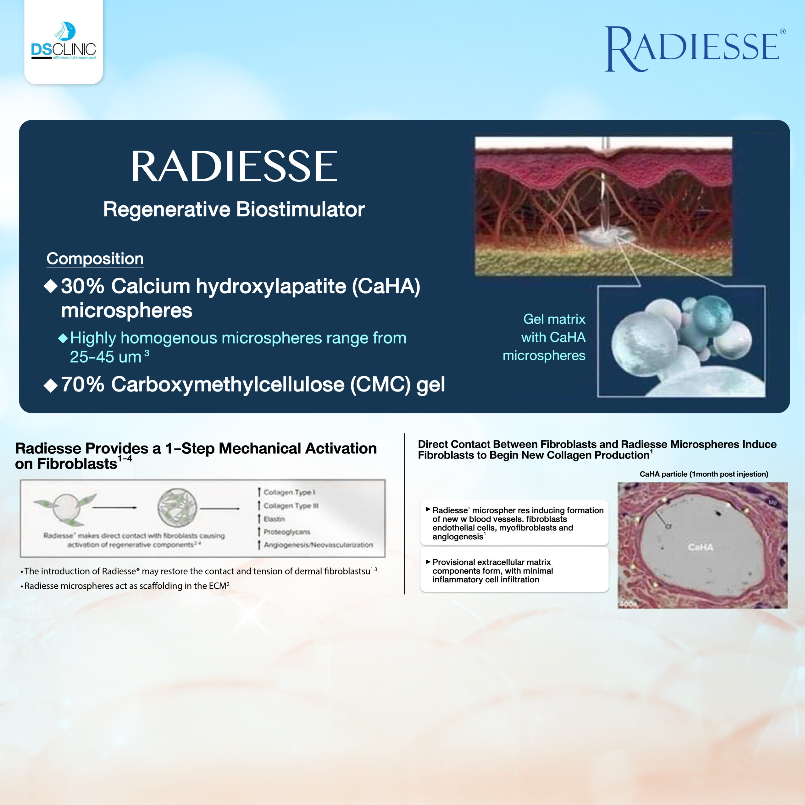 Radiesse Regenerative
