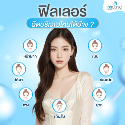 ฟิลเลอร์ฉีดตรงไหนได้บ้าง