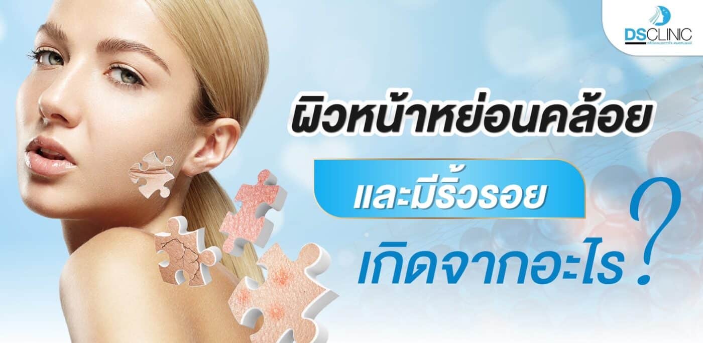 ภาพแสดงผิวหน้าหย่อนคล้อยและริ้วรอยบนผิวหน้า.