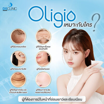 Oligio เหมาะกับใคร