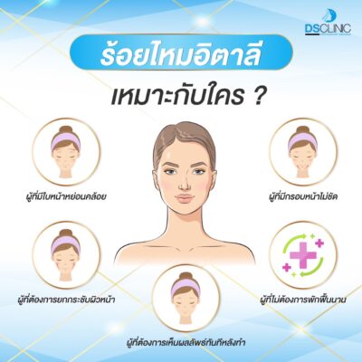 ร้อยไหมอิตาลีเหมาะกับใคร