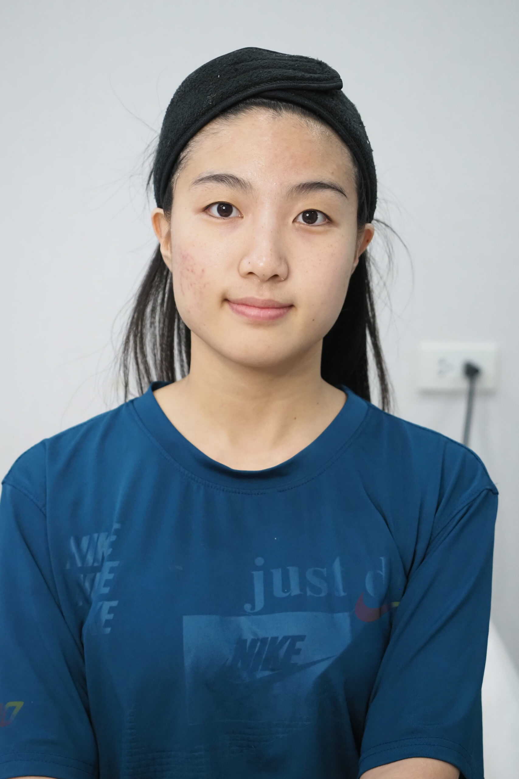 ก่อนทำ pico