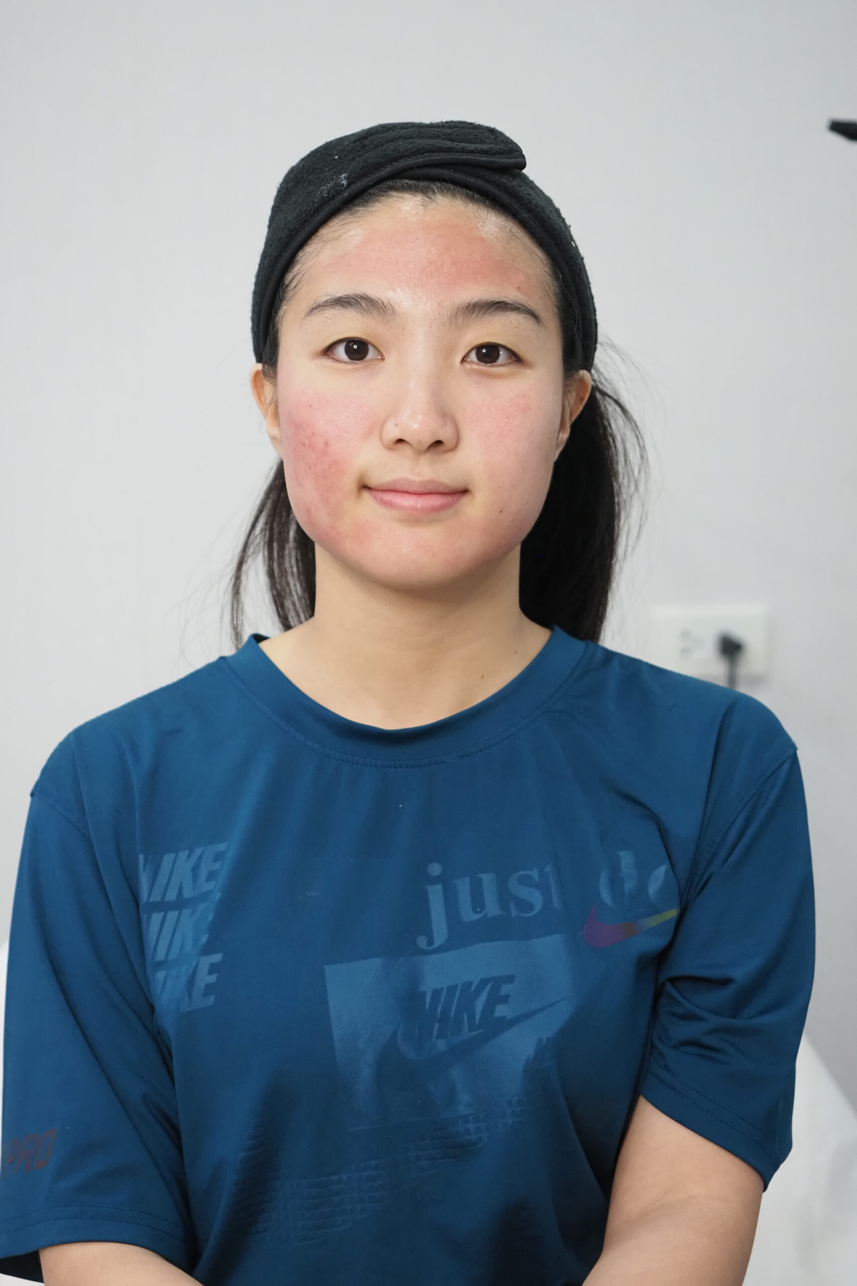 หลังทำ pico