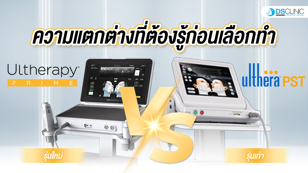 Ultherapy Prime กับ Ulthera SPT ต่างกันอย่างไร