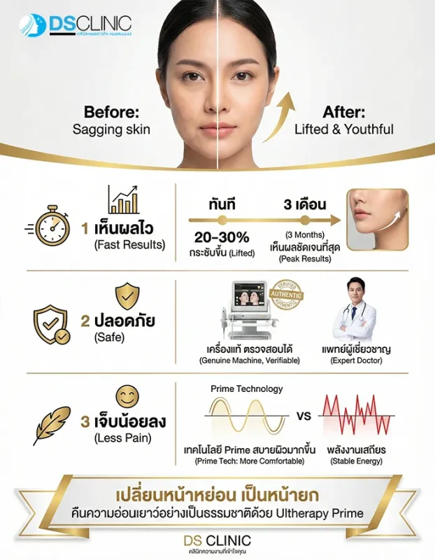 ทำไมต้องทำ Ultherapy Prime ที่ DS Clinic