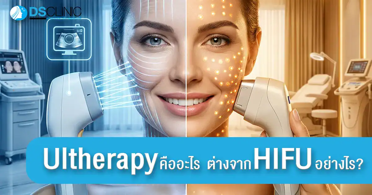 Ultherapy กับ HIFU เปรียบเทียบความแตกต่างของเทคโนโลยียกกระชับผิวหน้าโดยแพทย์ผู้เชี่ยวชาญ.