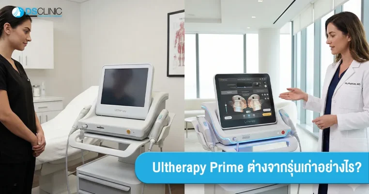 ภาพเปรียบเทียบเครื่องยกกระชับ Ultherapy รุ่นเก่า และ Ultherapy Prime รุ่นใหม่ล่าสุด พร้อมข้อความภาษาไทย "Ultherapy Prime ต่างจากรุ่นเก่าอย่างไร?"