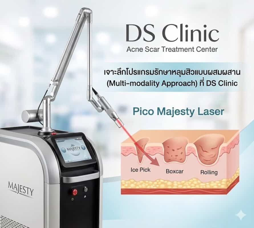 pico laser