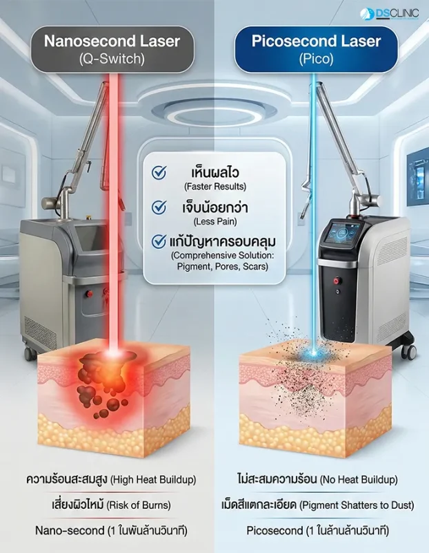 การเปรียบเทียบเทคโนโลยี Nanosecond Laser กับ Picosecond Laser ในด้านการสะสมความร้อนและการสลายเม็ดสี