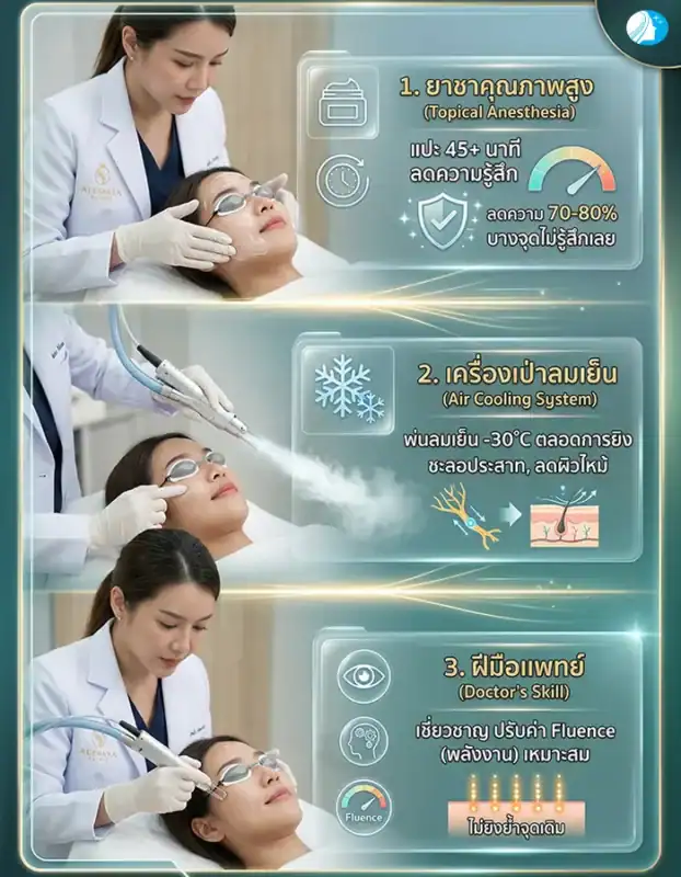 3 ตัวช่วยลดความเจ็บขณะทำ Pico Laser ได้แก่ ยาชาคุณภาพสูง, เครื่องเป่าลมเย็น -30 องศา และเทคนิคความเชี่ยวชาญของแพทย์ในการปรับพลังงาน