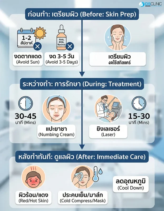 อินโฟกราฟิกขั้นตอนการเตรียมผิว การแปะยาชา และการดูแลผิวทันทีหลังทำ Pico Laser เช่น การประคบเย็นเพื่อลดอุณหภูมิผิว