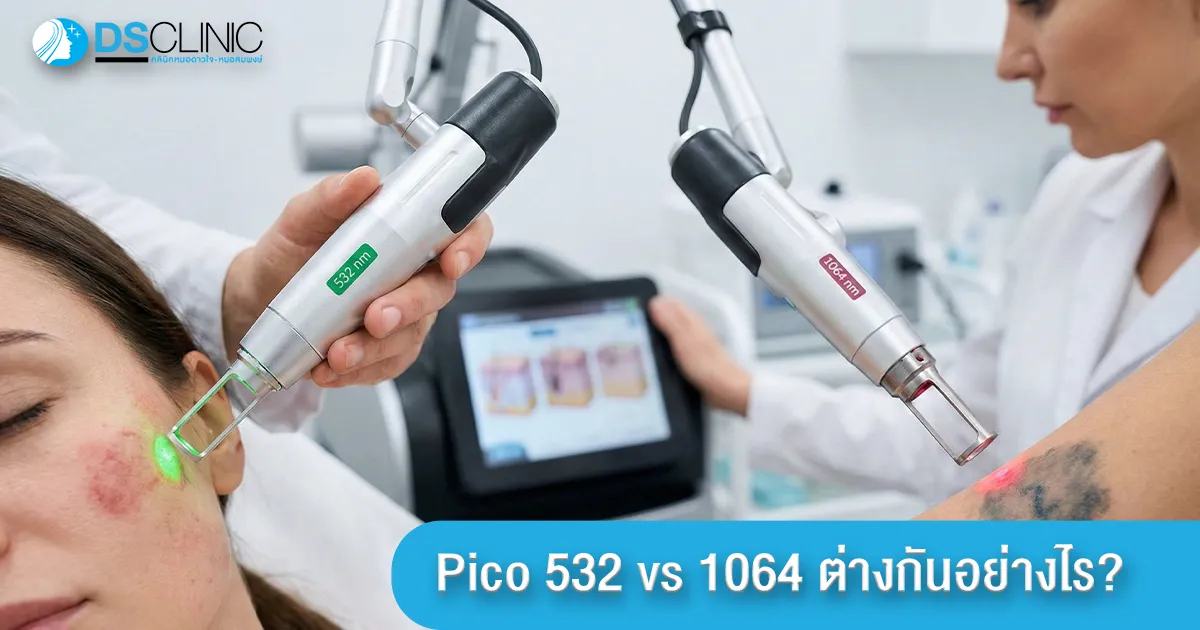 การเปรียบเทียบการใช้หัวยิง Pico Laser ความยาวคลื่น 532nm รักษาจุดด่างดำบนใบหน้า และ 1064nm