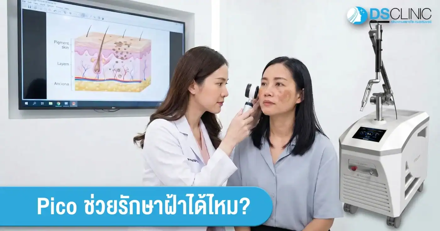 แพทย์ผู้เชี่ยวชาญใช้กล้องส่องตรวจวิเคราะห์ชนิดของฝ้าก่อนรักษาด้วย Pico Laser