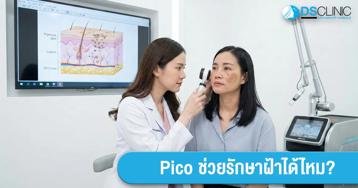 แพทย์ผู้เชี่ยวชาญใช้กล้องส่องตรวจวิเคราะห์ชนิดของฝ้าก่อนรักษาด้วย Pico Laser