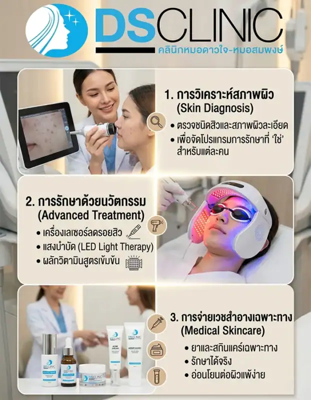 3 ขั้นตอนรักษาสิวที่เป็นเอกลักษณ์ของ DS Clinic ตั้งแต่การวิเคราะห์ผิว เลเซอร์ และเวชสำอาง