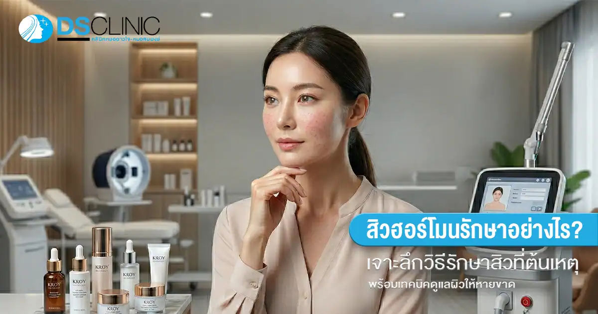 สิวฮอร์โมนรักษาอย่างไร? เจาะลึกวิธีรักษาสิวที่ต้นเหตุและเทคนิคดูแลผิวให้หายขาดโดย DS Clinic