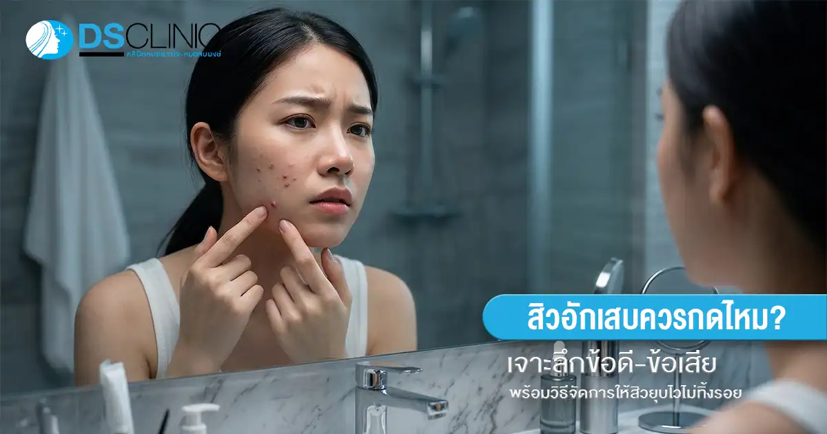 สิวอักเสบกดได้ไหม? เจาะลึกวิธีกดสิวอักเสบที่ถูกต้องและเทคนิคการดูแลโดยผู้เชี่ยวชาญจาก DS Clinic