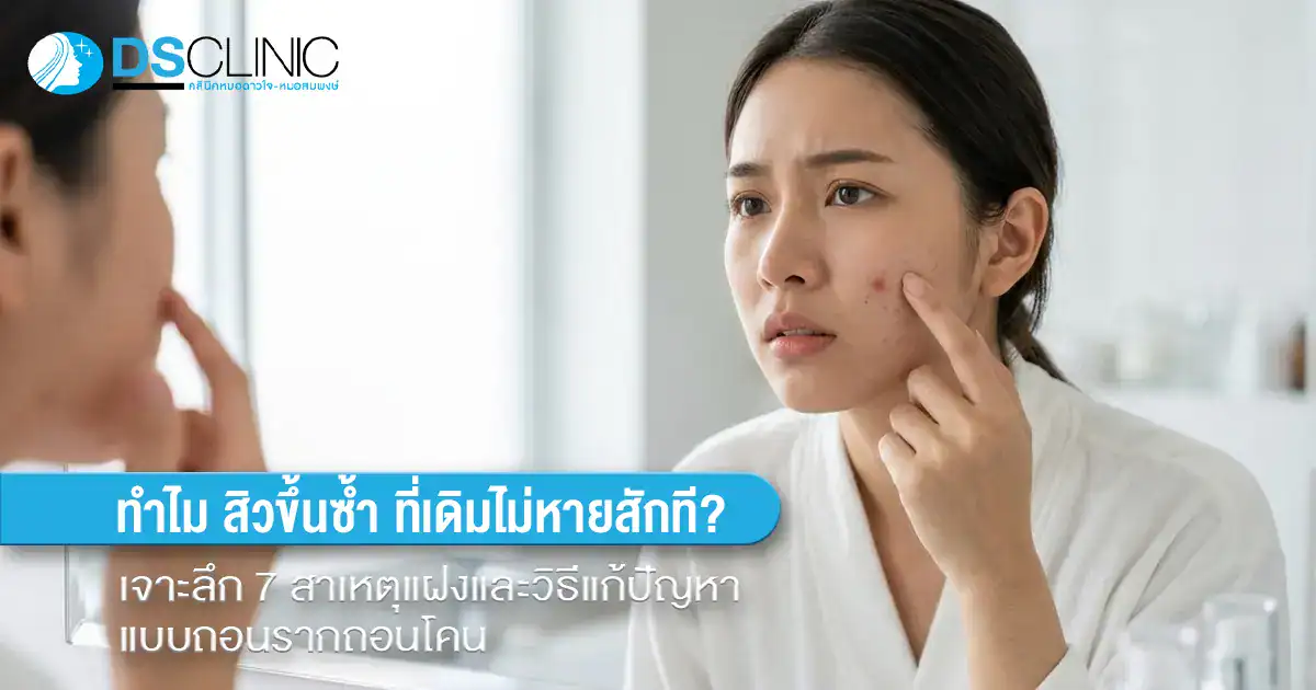 ผู้หญิงส่องกระจกด้วยความกังวลเรื่องสิวขึ้นซ้ำที่เดิม พร้อมข้อความเจาะลึก 7 สาเหตุแฝงและวิธีแก้ปัญหาสิวแบบถอนรากถอนโคน โดย DS Clinic