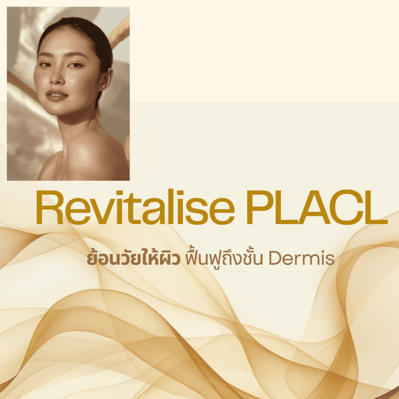REVITALISE