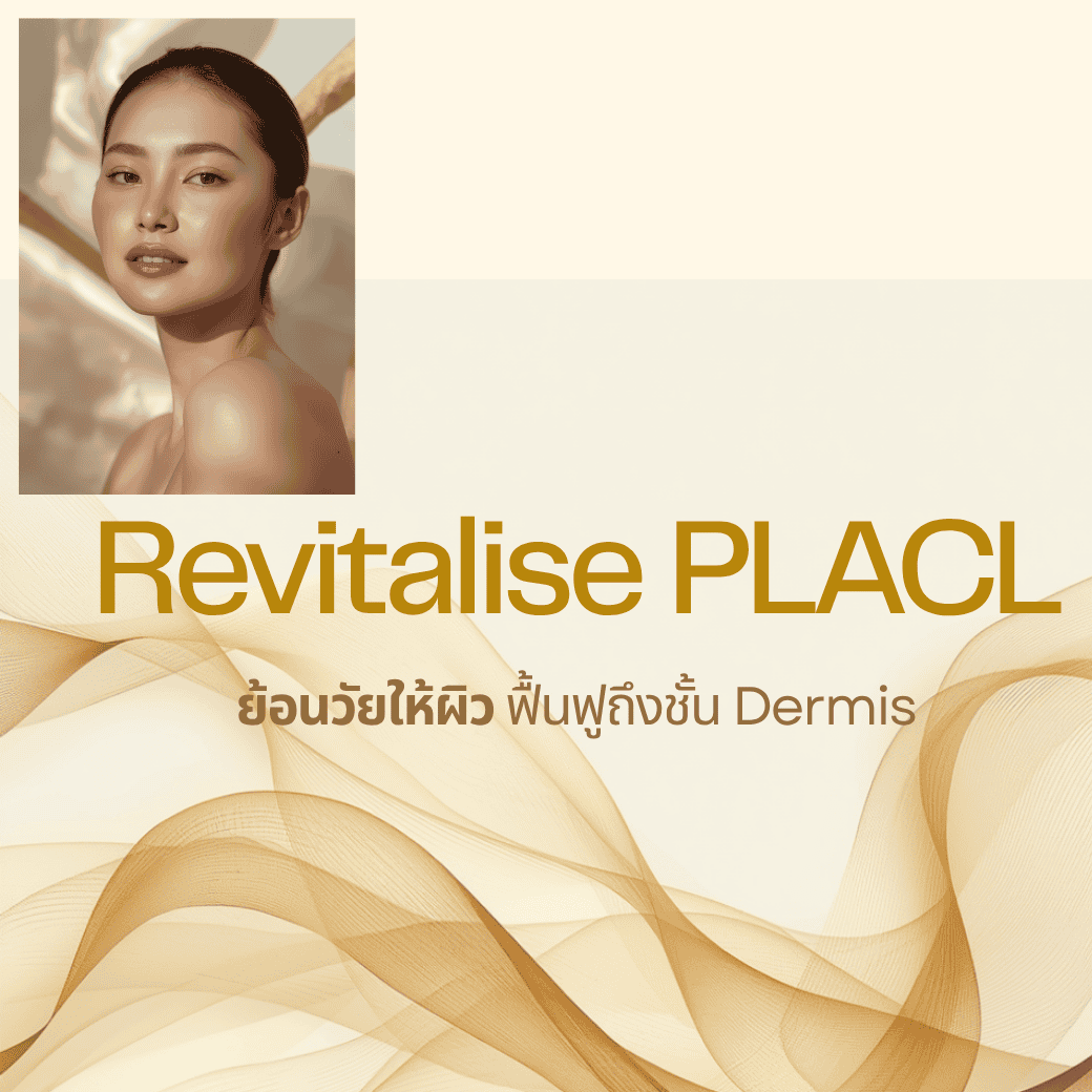 Revitalise PLACL ไหมกระตุ้นคอลลาเจนนวัตกรรมจากอิตาลี ที่ DS Clinic อุดรธานี