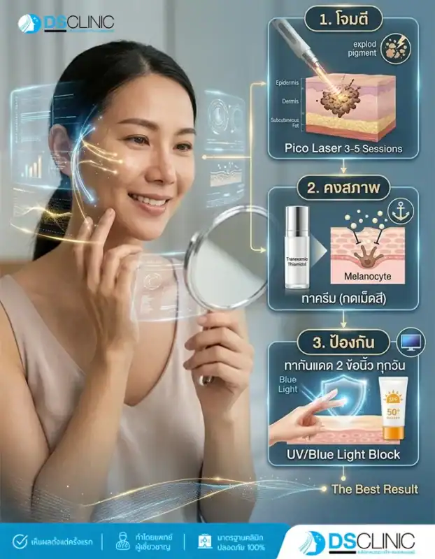 ขั้นตอนการรักษาฝ้าให้ได้ผลลัพธ์ที่ดีที่สุด 3 ขั้นตอน คือ 1. โจมตี (ทำ Pico Laser 3-5 ครั้งเพื่อสลายเม็ดสี) 2. คงสภาพ (ทาครีมที่มีส่วนผสมช่วยกดเม็ดสี) และ 3. ป้องกัน (ทาครีมกันแดด 2 ข้อนิ้วทุกวันเพื่อบล็อกรังสี UV และแสงสีฟ้า)