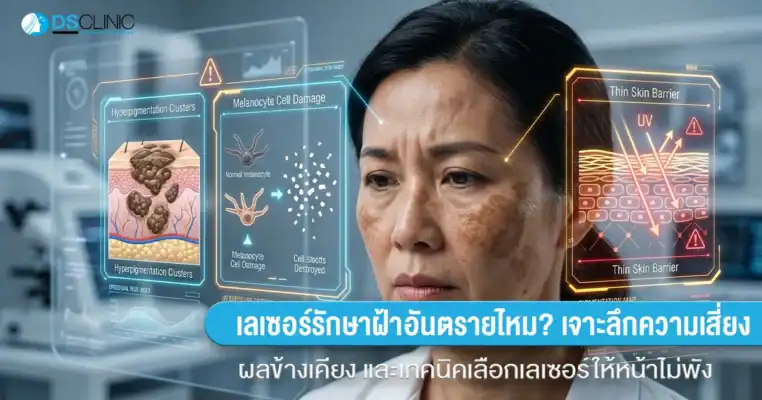 ภาพหน้าปก DS Clinic แสดงผู้หญิงมีฝ้าและกราฟิกวิเคราะห์ผิว มีข้อความถามว่า เลเซอร์รักษาฝ้าอันตรายไหม? เจาะลึกความเสี่ยง ผลข้างเคียง และเทคนิคเลือกเลเซอร์ให้หน้าไม่พัง