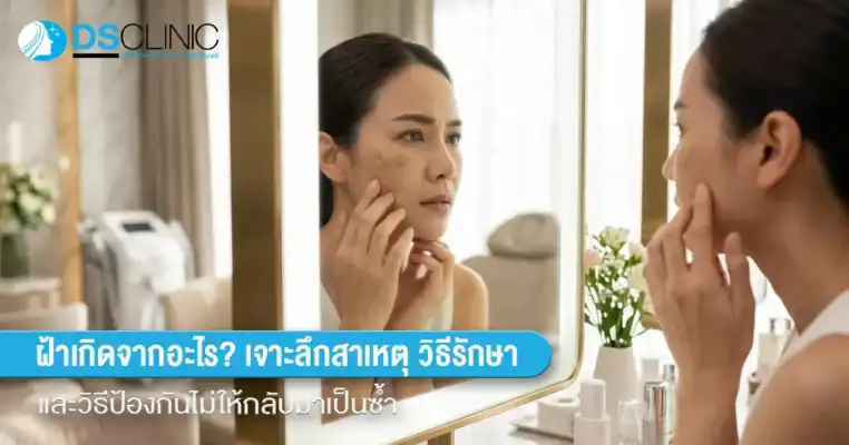 ผู้หญิงส่องกระจกด้วยความกังวลเรื่องปัญหาฝ้าบนใบหน้า พร้อมข้อความอธิบายสาเหตุและวิธีรักษาฝ้าแบบเจาะลึก โดย DS Clinic